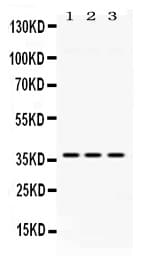 Polyclonal Rabbit anti-Human GNB1 Antibody (IHC, WB)