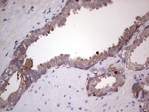 Monoclonal Mouse anti-Human PKM2 Antibody (clone 1F12, IHC, WB)