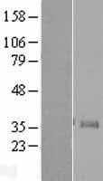 Human NEUROG1 / NGN1 / Neurogenin 1 Protein (Over-Expression Lysate Myc-DDK (Flag))