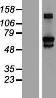 GFPT2 Protein (Over-Expression Lysate Myc-DDK (Flag))