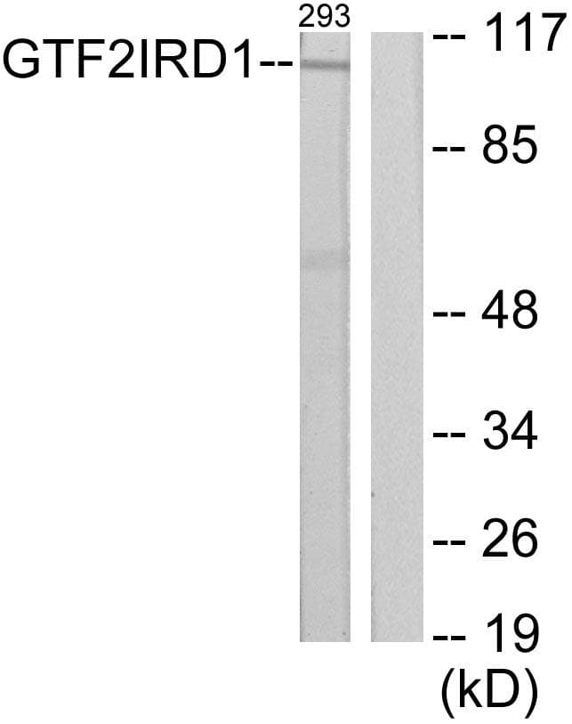 Polyclonal Rabbit anti-Human GTF3 / GTF2IRD1 Antibody (WB)