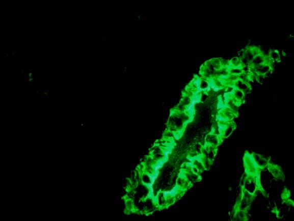 IHC-plus™ KRT7 / CK7 / Cytokeratin 7 Antibody (clone RCK105)