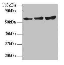 IHC-plus™ TIMP2 Antibody (aa 30-220)