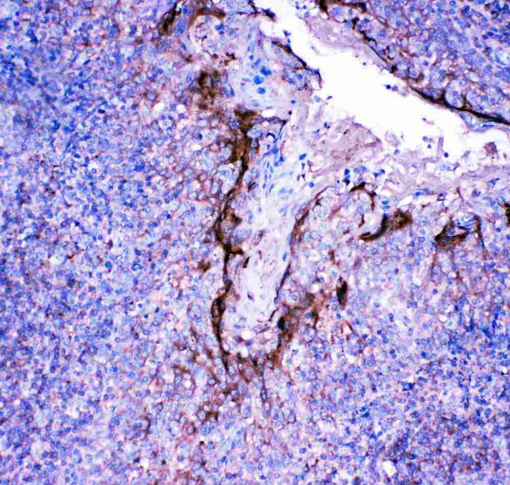 Polyclonal Rabbit anti-Human PFN2 / Profilin 2 Antibody (aa125-140, IHC, WB)