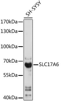 SLC17A6 / VGLUT2 Antibody