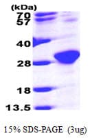 Human RAB6A / RAB6 Protein (Recombinant His)