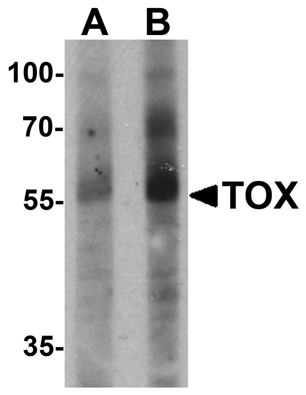 IHC-plus™ TOX Antibody