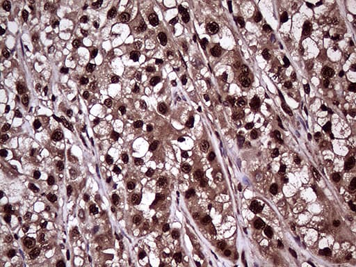 Monoclonal Mouse anti-Human PPP4C Antibody (clone OTI2H7, IHC, WB)