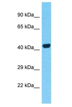 Polyclonal Rabbit anti-Human PTRF / CAVIN Antibody (aa214-263, WB)