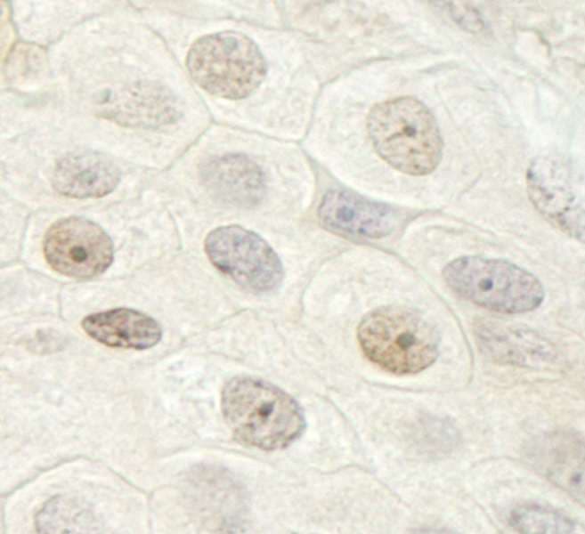 Polyclonal Rabbit anti-Human DDX33 / DHX33 Antibody (aa1-50, IHC)