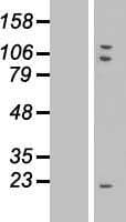 TMEM85 Protein (Over-Expression Lysate Myc-DDK (Flag))