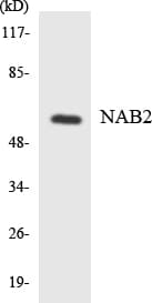 NAB2 Antibody (aa257-306)