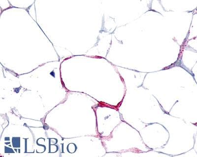 PathPlus™ Polyclonal Rabbit anti-Human VIPR1 Antibody (Cytoplasmic Domain, IHC)