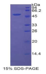 Rat FSIP1 Protein (Recombinant His-GST)