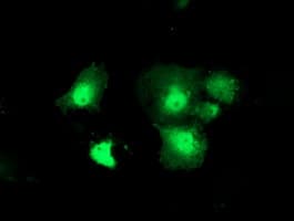 Thymidylate Kinase Antibody (clone OTI1G8)