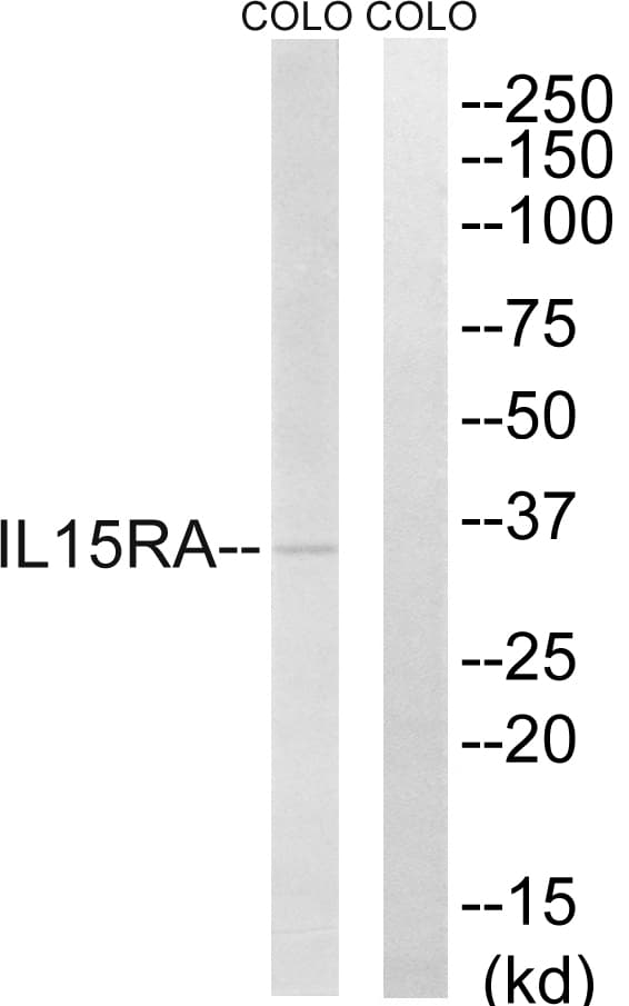 IL15RA Antibody (aa99-148)