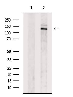 CYFIP2 / PIR121 Antibody