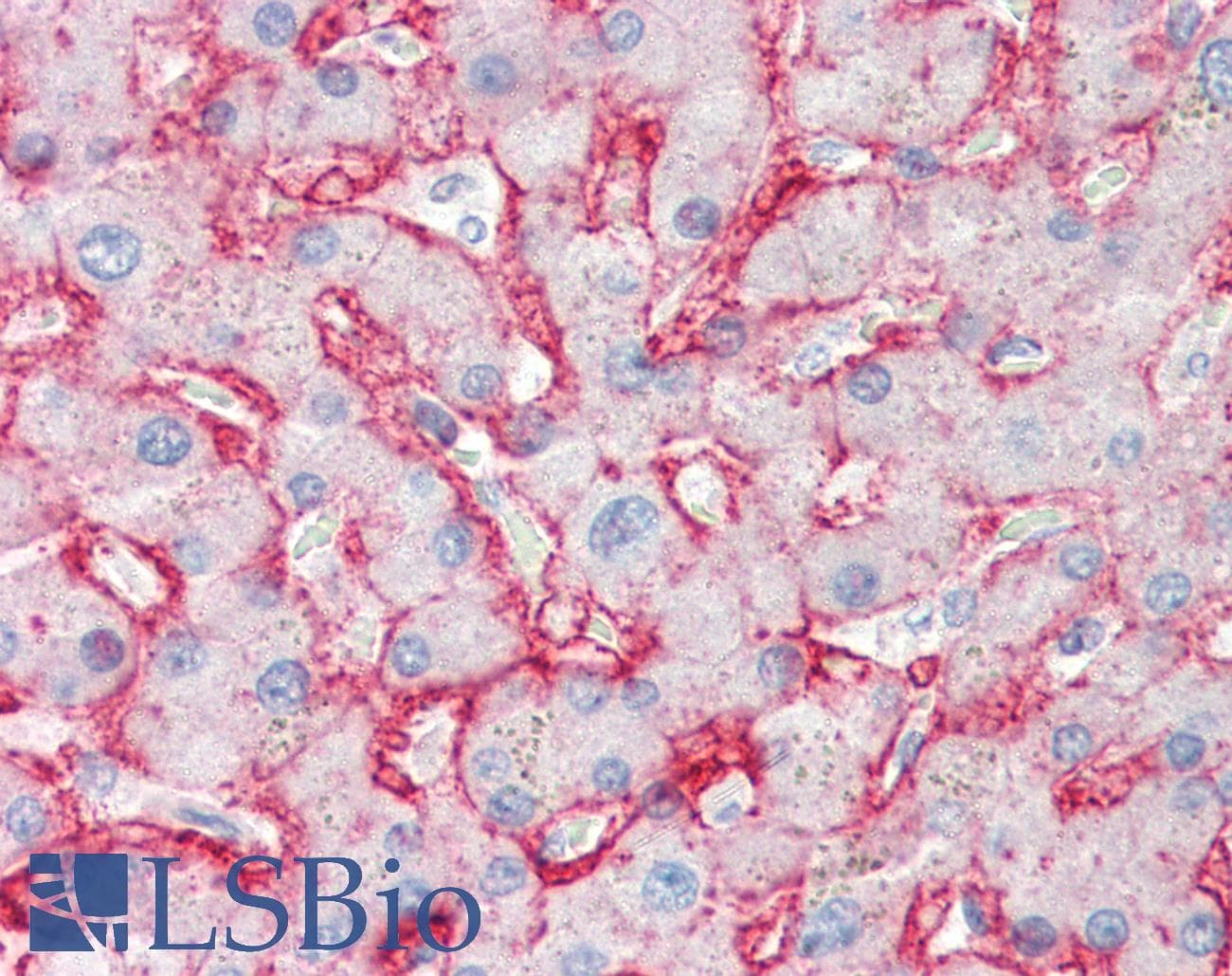 IHC-plus™ SLC2A2 / GLUT2 Antibody (clone 199017)