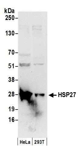 HSPB1 / HSP27 Antibody (aa150-200)