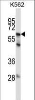 MMP11 Antibody (aa399-428)