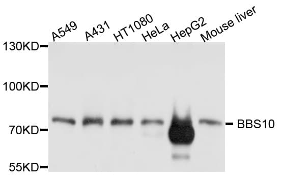BBS10 Antibody