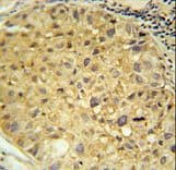 Polyclonal Rabbit anti-Human DDC / DOPA Decarboxylase Antibody (aa32-61, IHC, IF, WB)