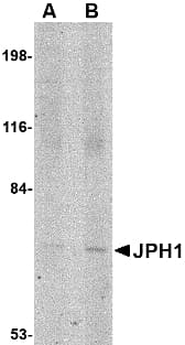 JPH1 Antibody