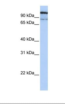 GAA / Alpha-Glucosidase, Acid Antibody (aa218-267)