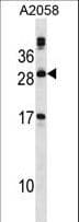 Polyclonal Rabbit anti-Human PLA2G12A Antibody (aa55-83, WB)