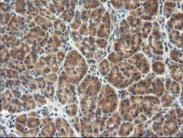 TFG Antibody (clone OTI2C3)