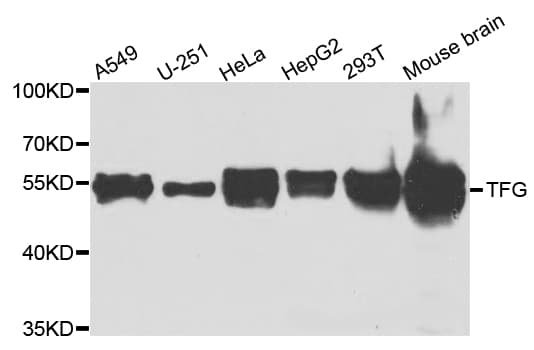 TFG Antibody