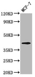 Polyclonal Rabbit anti-Human OPN1MW / GCP Antibody (IF, WB)