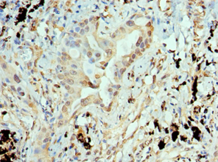 ANTXR1 / TEM8 Antibody (aa315-564)