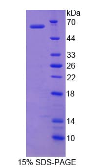 Human USP14 Protein (Recombinant His)