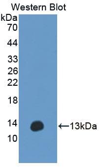 ANO6 Antibody (aa744-824, PE)