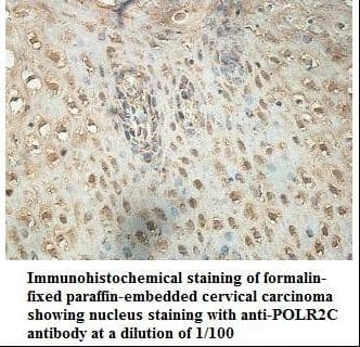POLR2C Antibody (aa38-238)