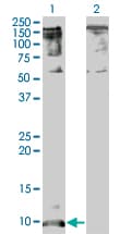 IHC-plus™ CXCL5 Antibody (clone 2A9)