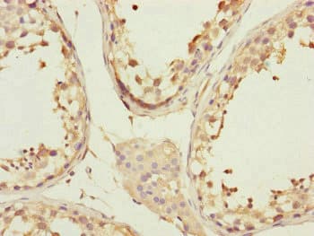 Polyclonal Rabbit anti-Human CCHCR1 Antibody (IHC, WB)