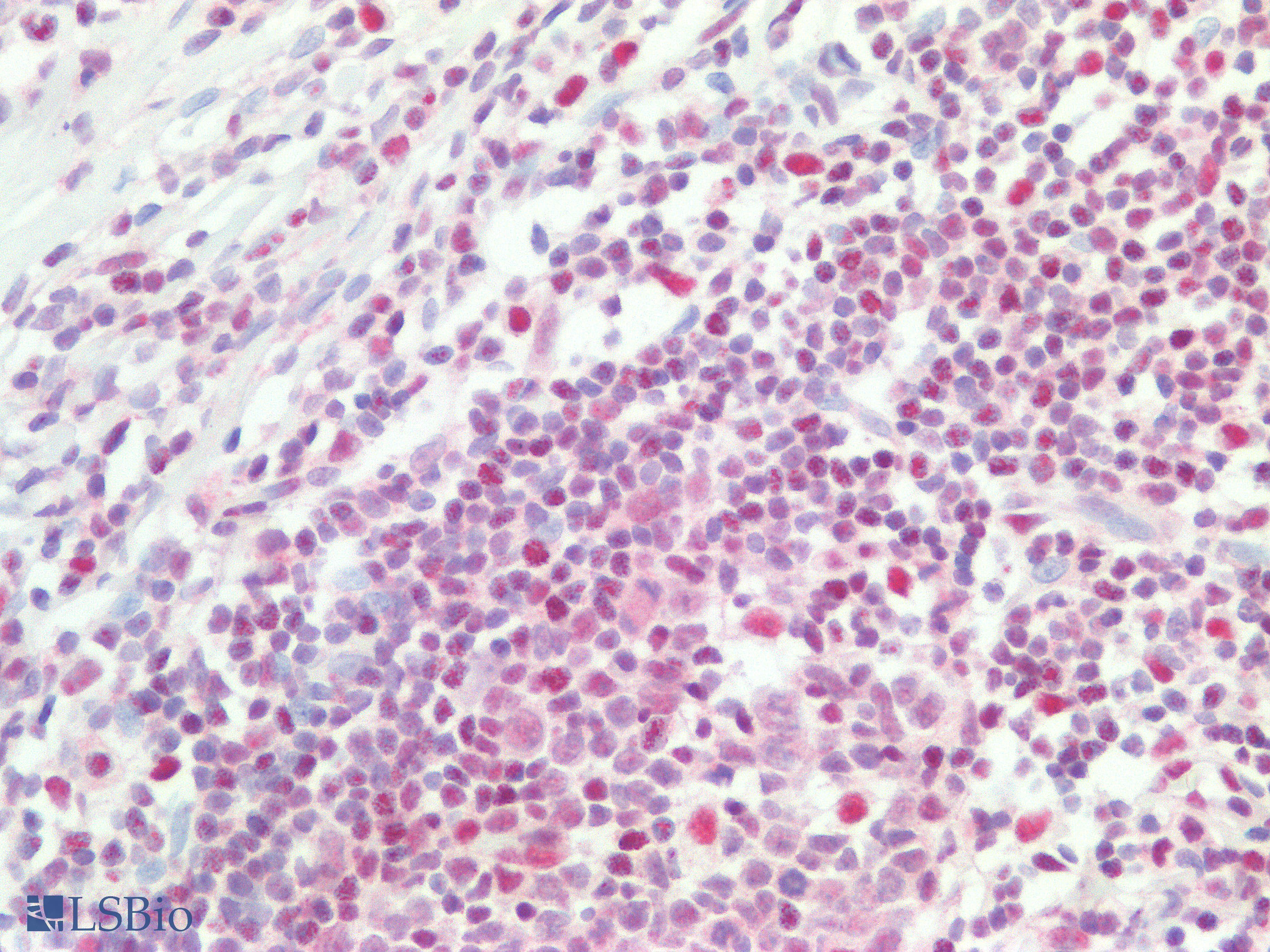 PathPlus™ Monoclonal Mouse anti-Human TFE3 Antibody (clone AHC0245, Ready-to-Use, IHC, WB)