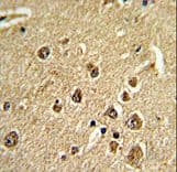 MTA2 Antibody (aa516-544)