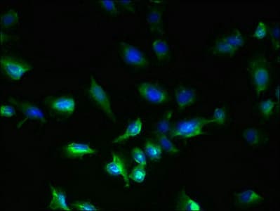 GPCRW / GPR18 Antibody