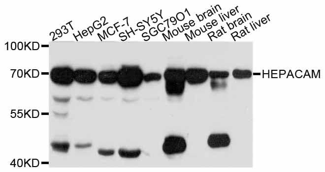Polyclonal Rabbit anti-Human HEPACAM Antibody (WB)