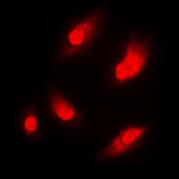Polyclonal Rabbit anti-Human NARG1 / NAA15 Antibody (Internal, IHC, IF, WB)