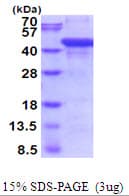Human AGA / Aspartylglucosaminidase Protein (Recombinant His)