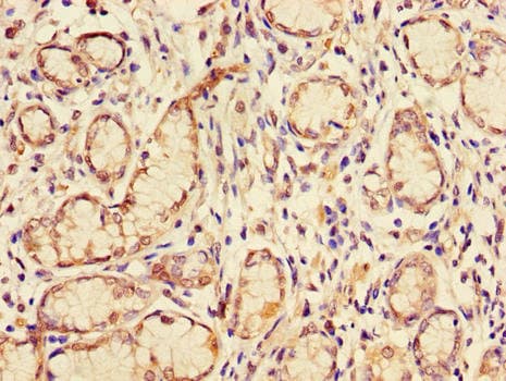 GJB2 / CX26 / Connexin 26 Antibody