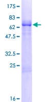 Human HPH2 / PHC2 Protein (Recombinant GST)