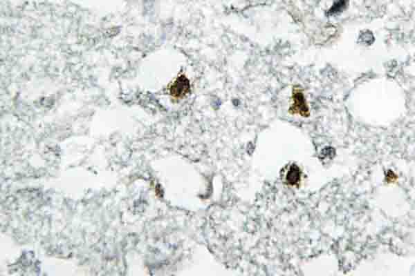 Polyclonal Rabbit anti-Human CDKN1B / p27 Kip1 Antibody (Ala181, IHC, WB)