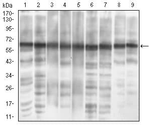 EIF2A / EIF2 Alpha Antibody (aa448-576, clone 3A7B11)
