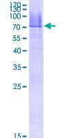 Human HLA-E Protein (Recombinant GST)