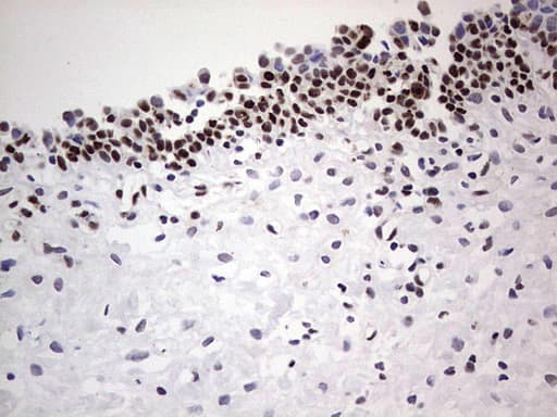 SAE1 Antibody (clone OTI3C3)